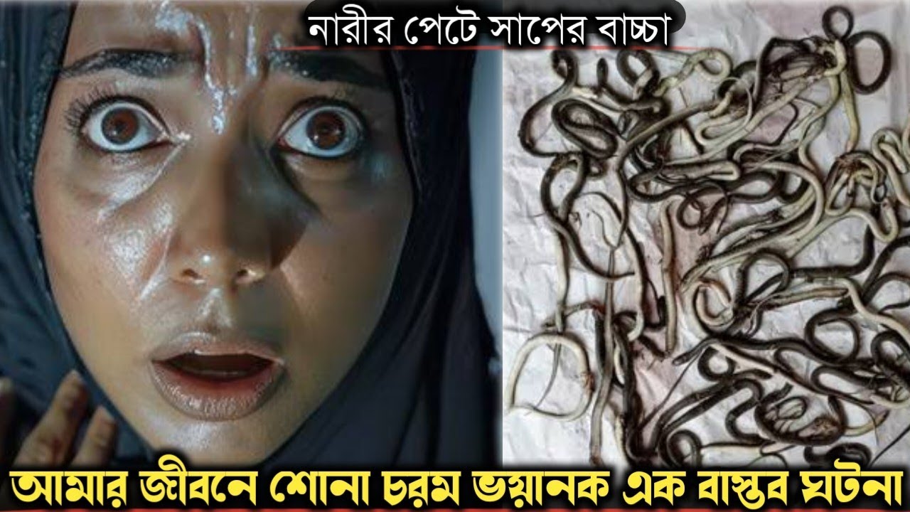 বমির সাথে বেরিয়ে এলো মেয়ের পেট থেকে অসংখ্য বিষদর  সাপের বাচ্চা (বাস্তব ঘটনা Bangla real life story
