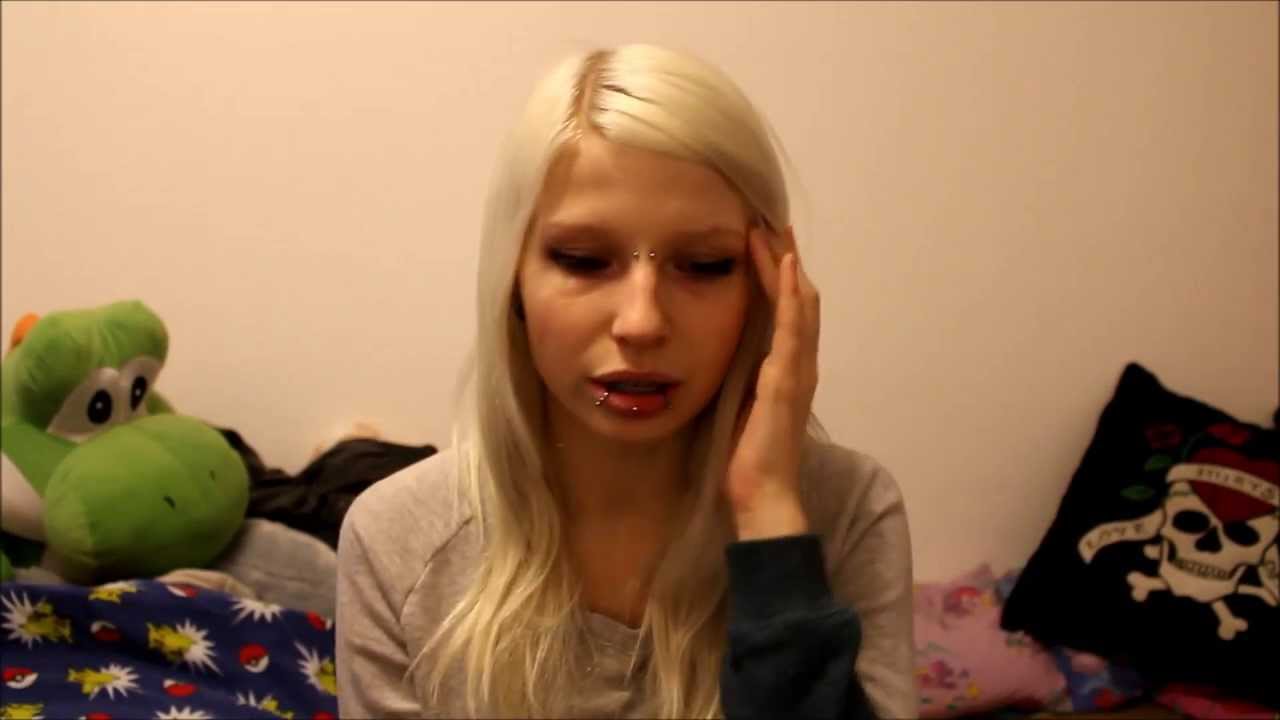 F&A: OMG eine Zahnspange! | ❄ Lilith Whitic ❄