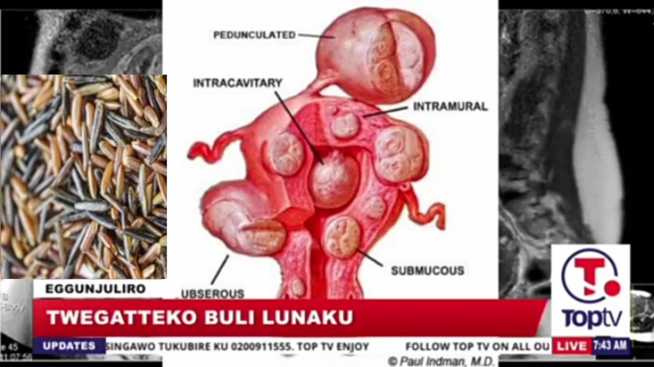 Buli Mukyala: EBIZIMBA KU NABAANA. Kola bino Wejjanjabe Owone