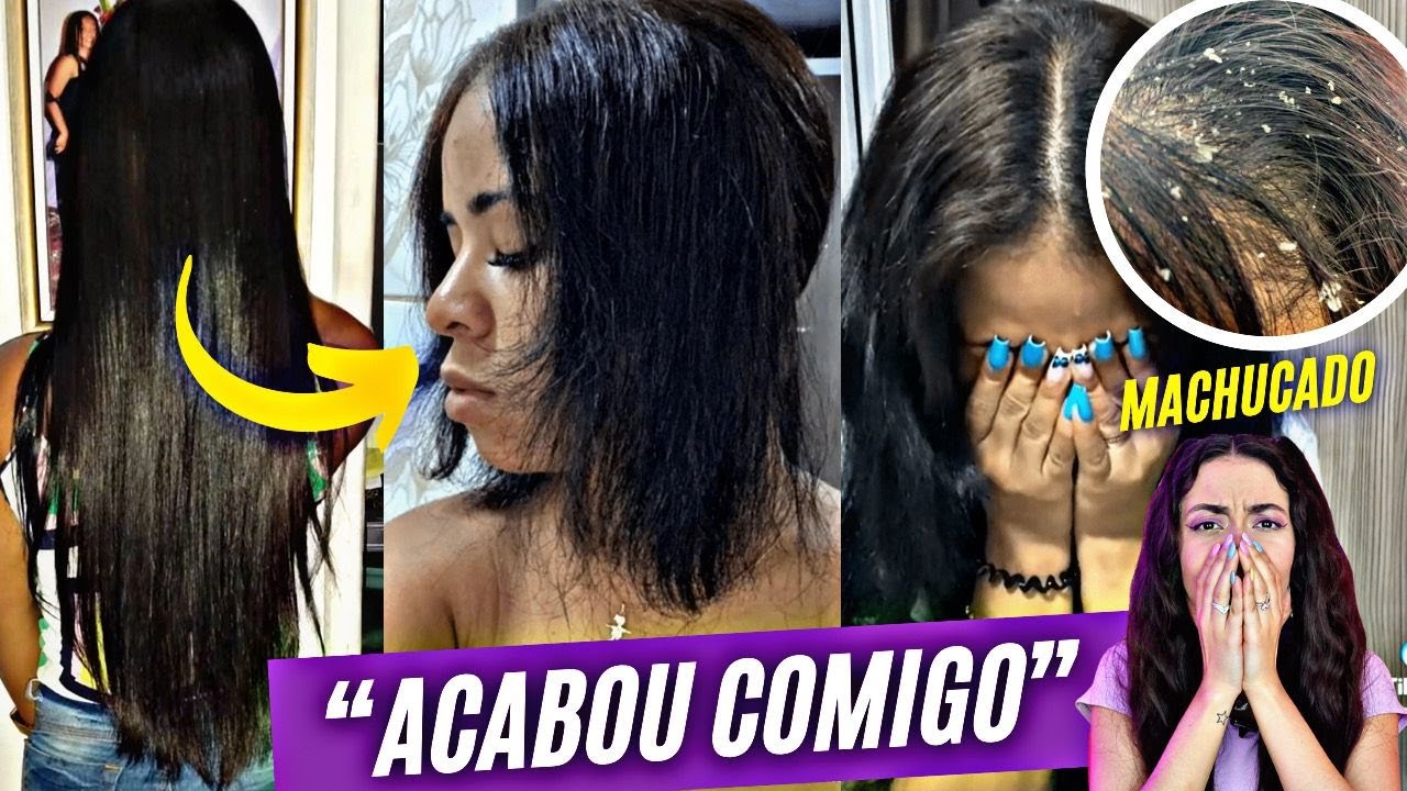 VEJA O DESASTRE CAPILAR COM FORMOL QUE VIRALIZOU! JOVEM TEVE TERRÍVEL CORTE QUÍMICO ⚠️