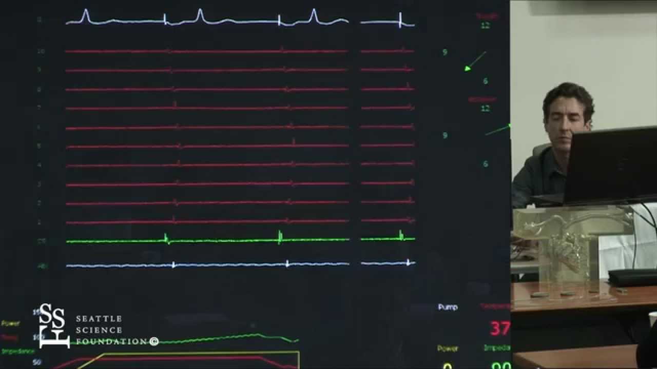 Atrial Flutter Simulation Demonstration by Adam Zivin, M.D.