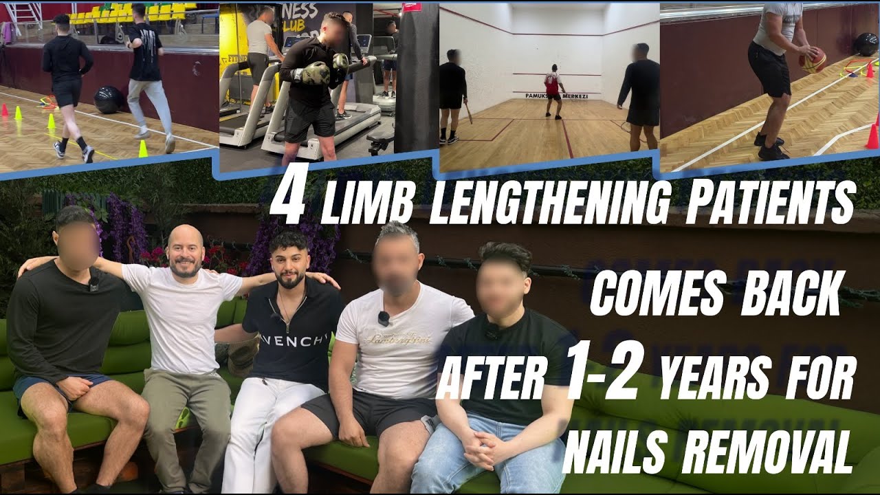 4 LIMB LENGTHENING PATIENT COME BACK AFTER 1-2 YEARS FOR NAIL REMOVAL