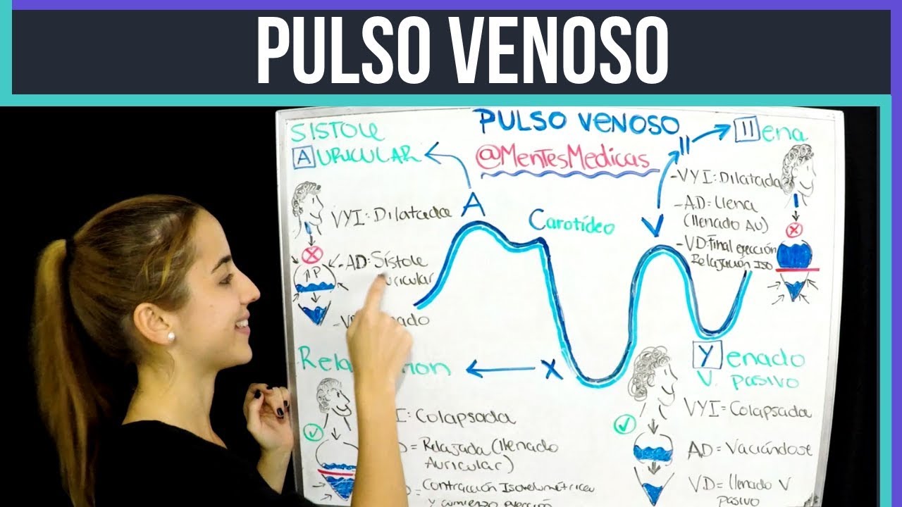 PULSO VENOSO + MNEMOTECNIA + PATOLOGIAS  | Mentes Médicas