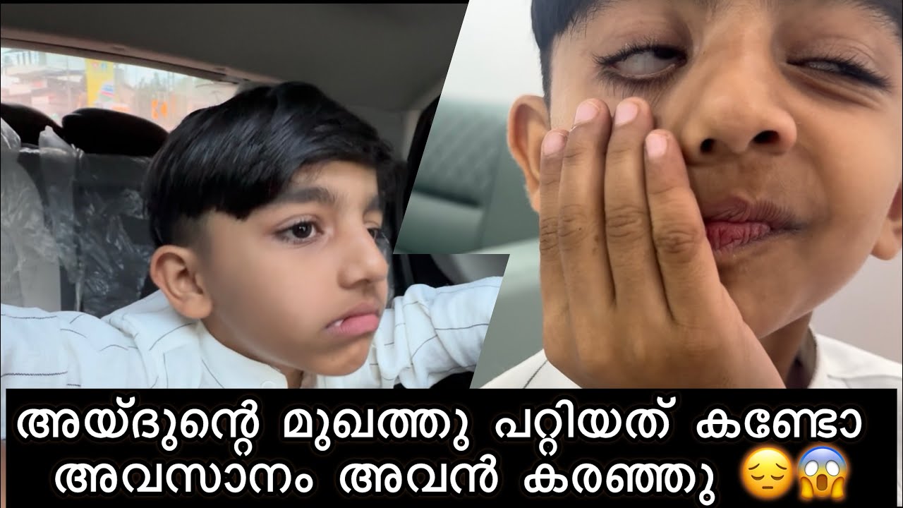 അയ്ദുന്റെ മുഖത്തു പറ്റിയത് കണ്ടോ അവസാനം അവൻ കരഞ്ഞു 😔😱|Aydhuspappa|