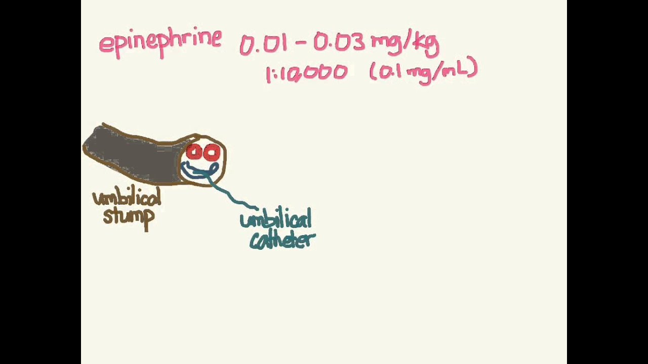 Neonatal Resuscitation 02