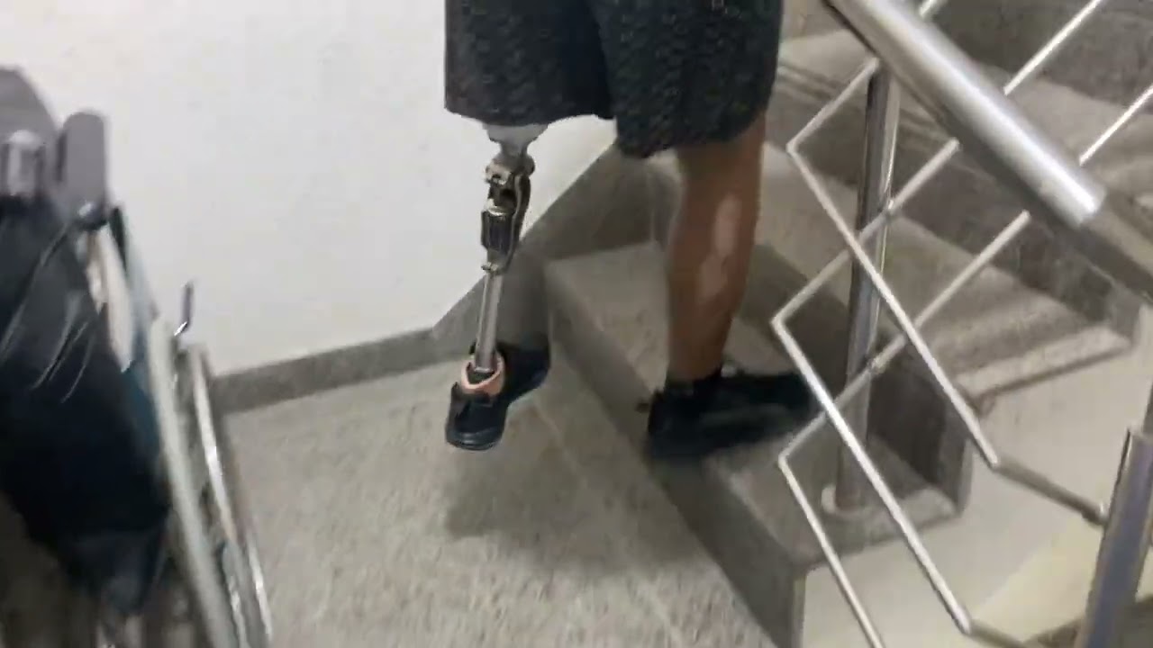 Nakli Tang l Nakli Per l best artificial limb clinic | OP4 knee joint | above knee prosthesis