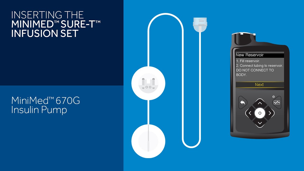Inserting the Sure-T Infusion Set with the MiniMed 670G Insulin Pump