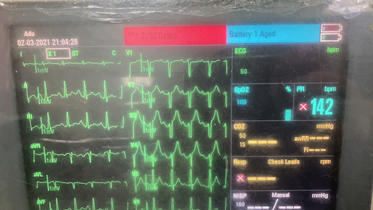Oximetry sounds