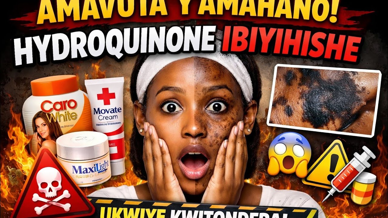 “ Ibanga Abacuruza Amavuta Benshi Batakubwira: Aya mavuta arimo Hydroquinone Yangiza Uruhu!”
