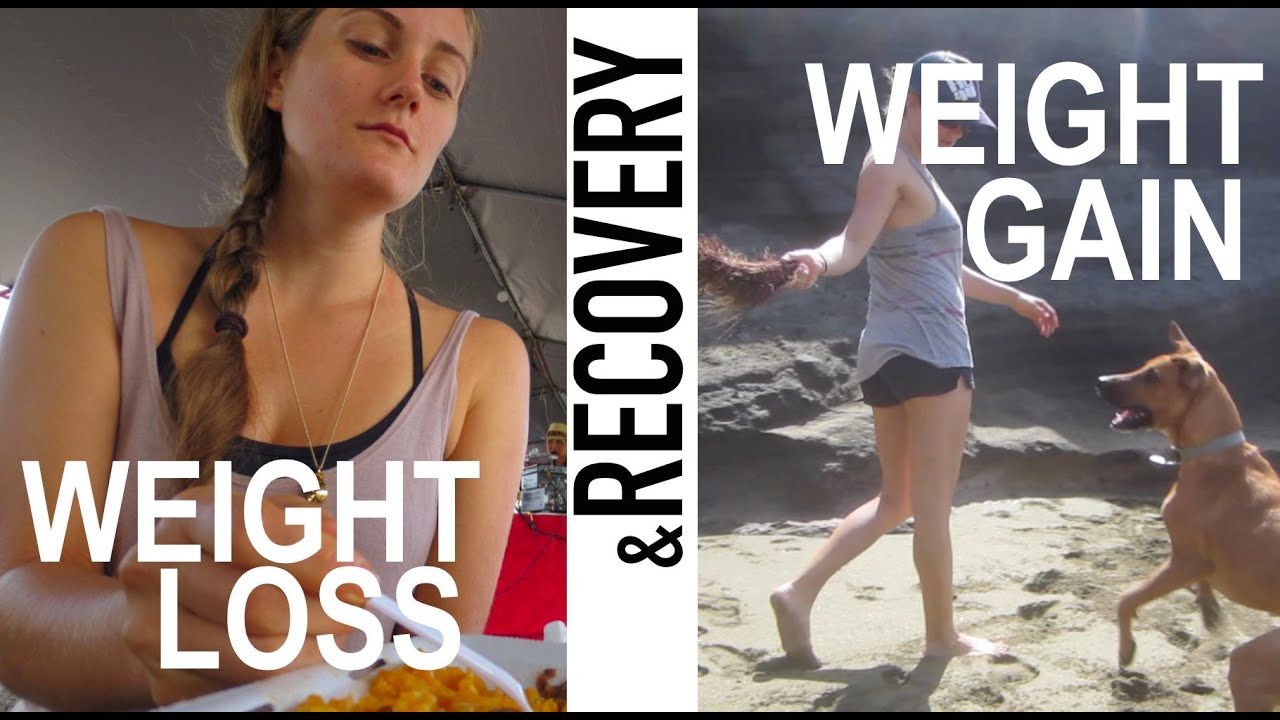 My Eating Disorder - Weight Loss, Weight Gain, & Recovery