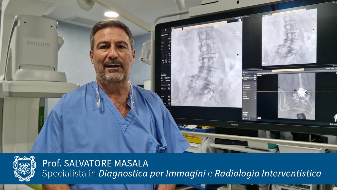 Prof. Salvatore Masala, Stenosi lombare e distanziatori interspinosi