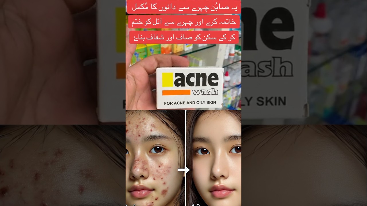 Acne Wash Soap Chahre pe dano ko khatam krne aur Chahre ka rang gora krne k lie mufed hy #shorts