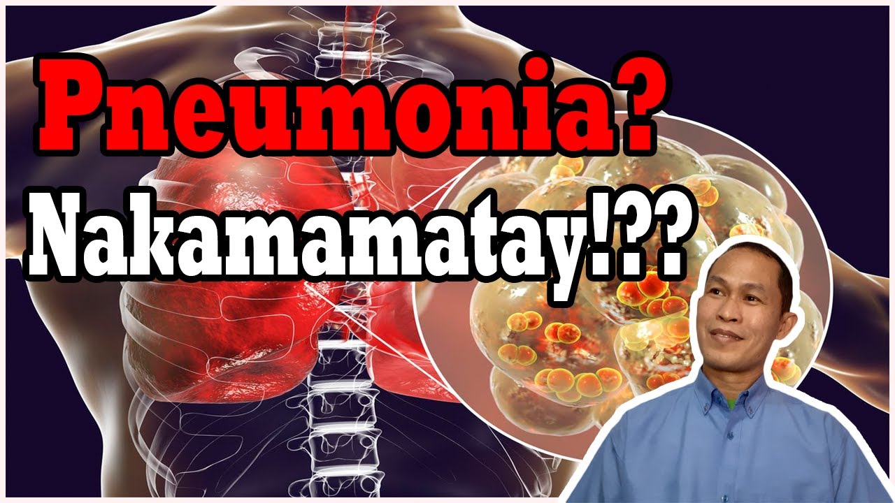 Pneumonia? Nakamamatay?