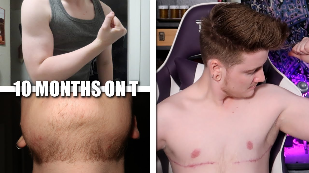 10 Months on Testosterone! Changes! Body/Voice/Beard/Muscle // FTM Transgender