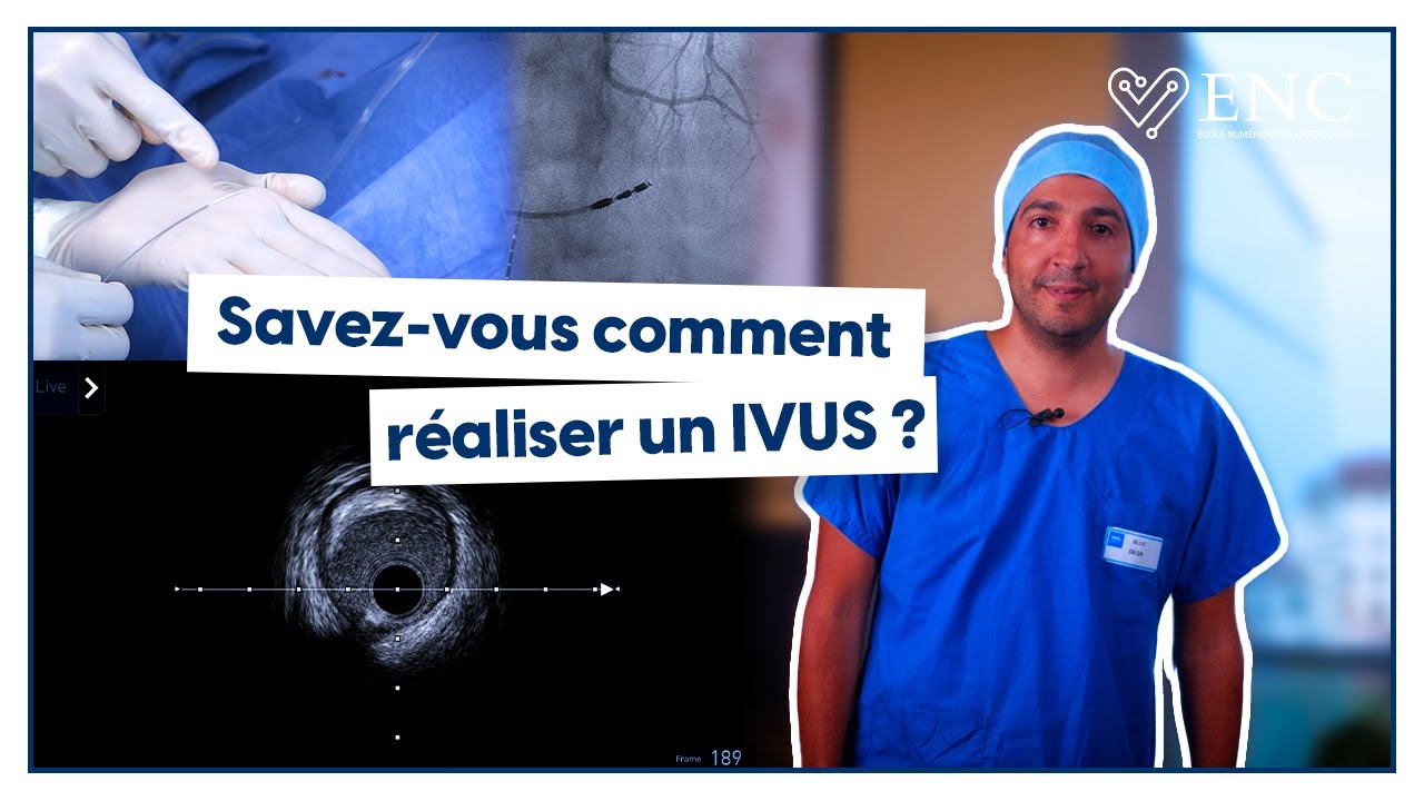 Comment r&eacute;aliser un IVUS ?