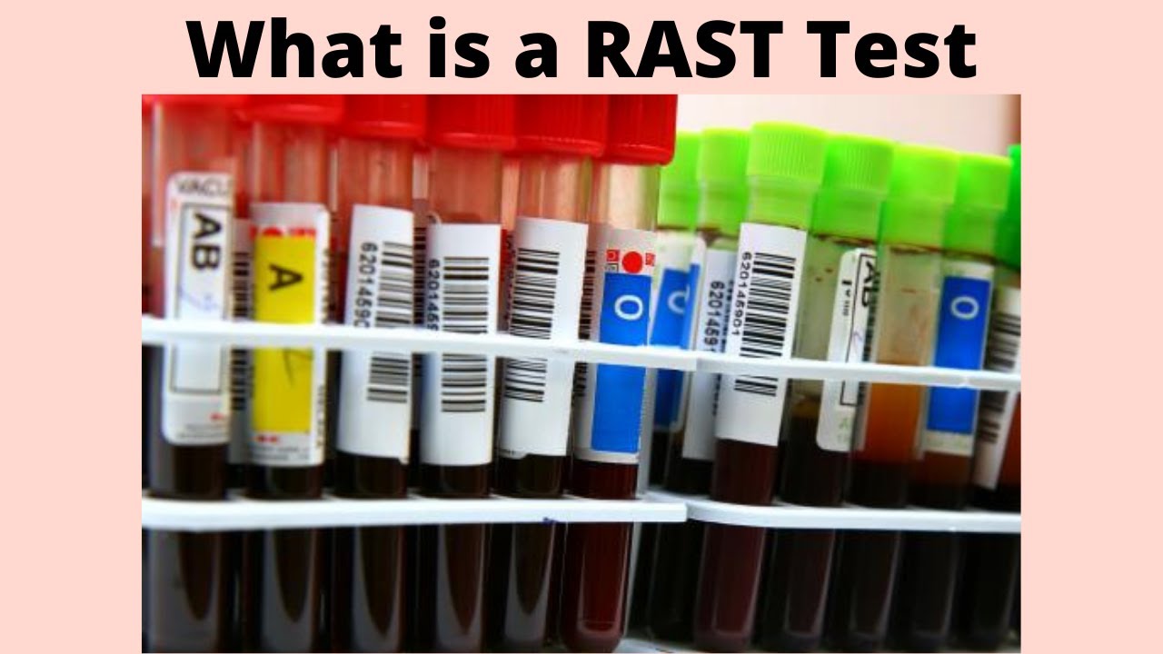 What is a RAST Test