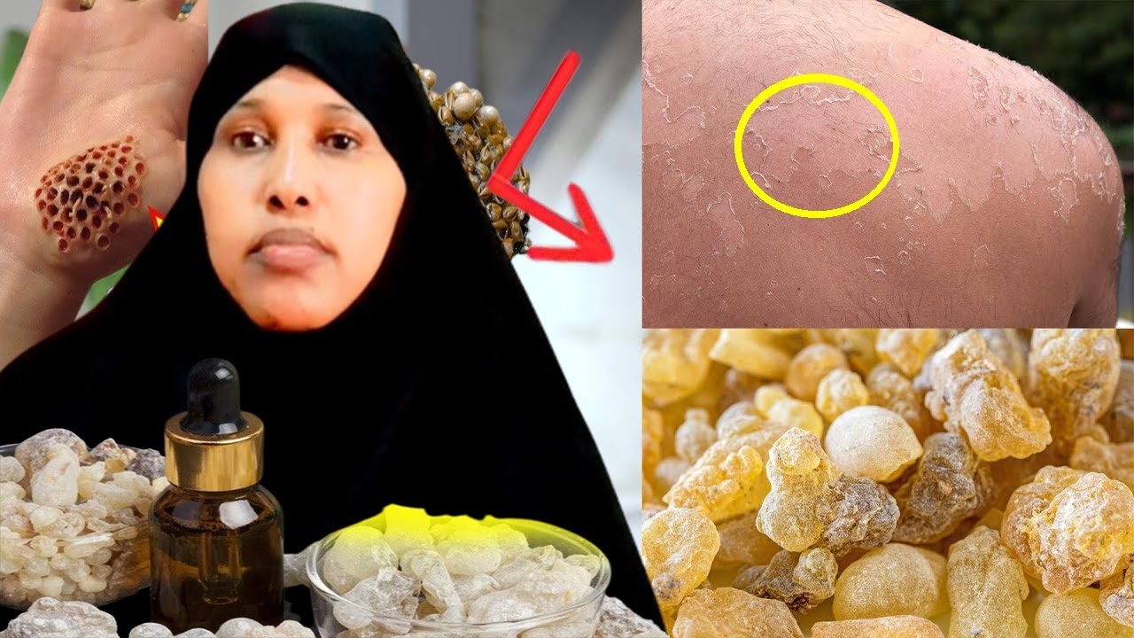 Faaiidada Geedkan kujirta Hadaad ogaan Lahayd wax kale ma isticmashen jirka iyo Guriga sidu kadhigin