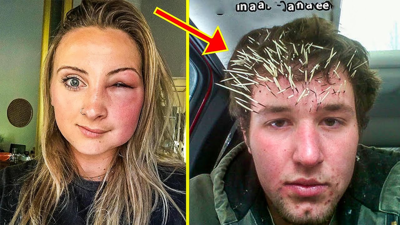People Having A Worse Day Than You - part 2