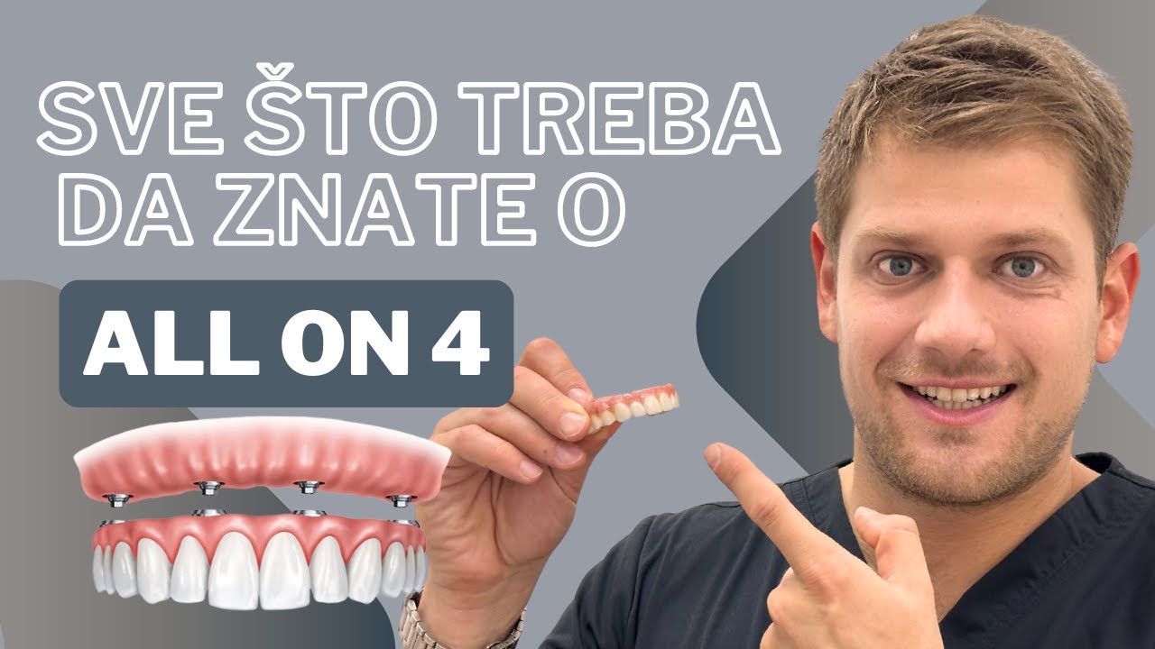 Sve Što Treba Da Znate O All on 4 - Svi Zubi Na 4 Implanta