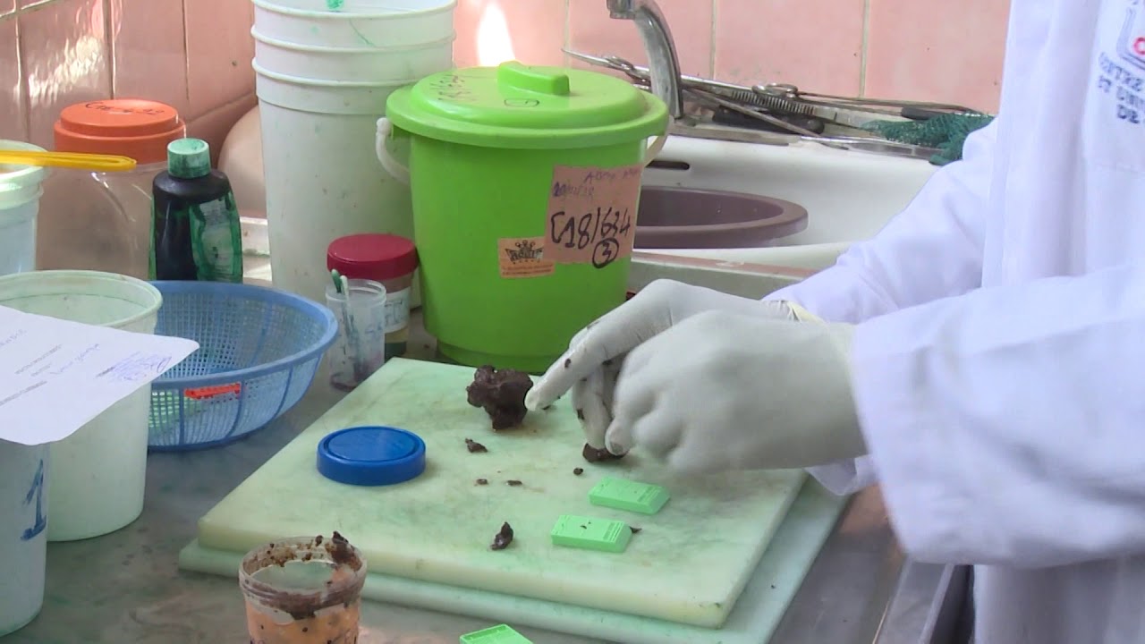 Santé: L'Anatomie Pathologiste, une discipline peu connue en Côte d'Ivoire