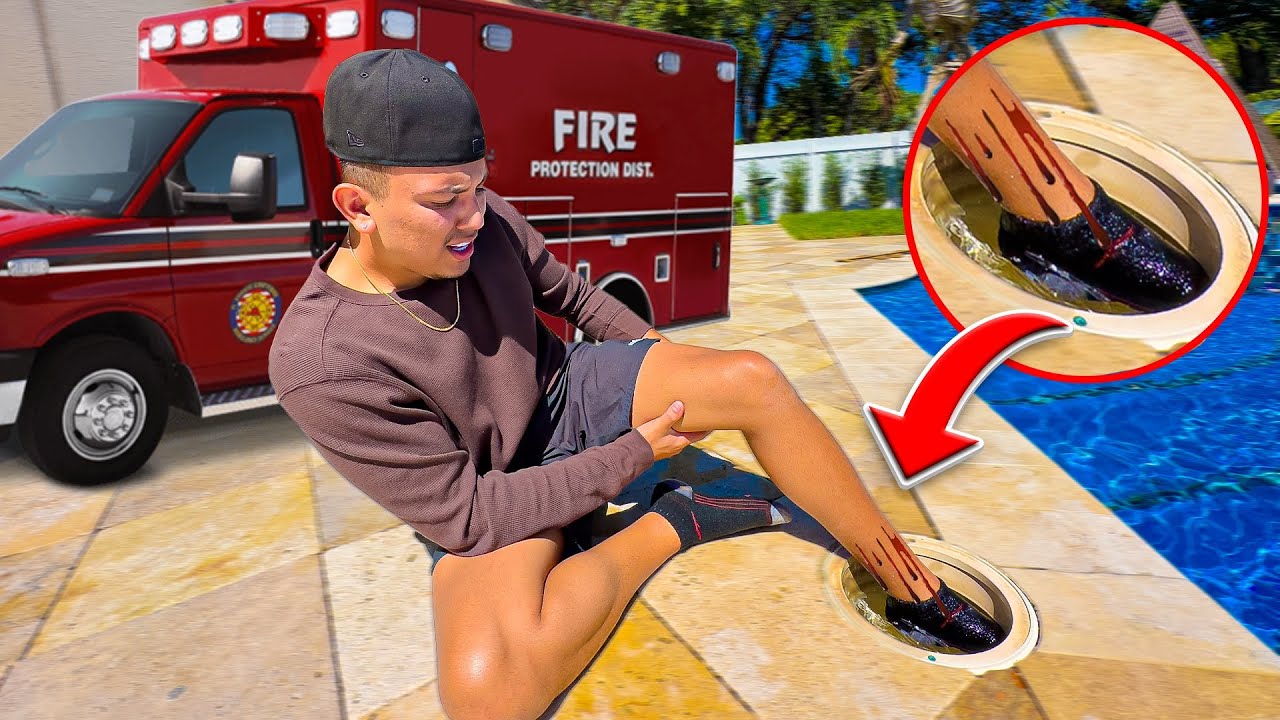 I ALMOST LOST MY FOOT!!