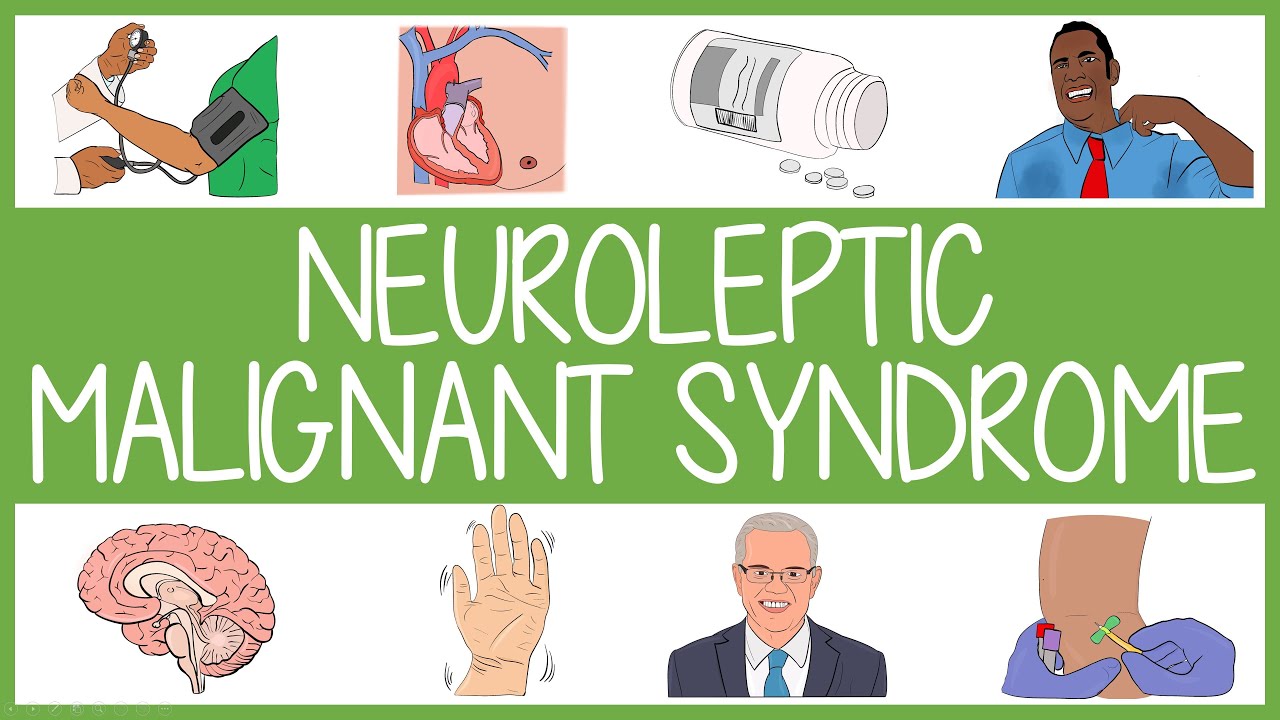 Neuroleptic Malignant Syndrome in 3 Minutes