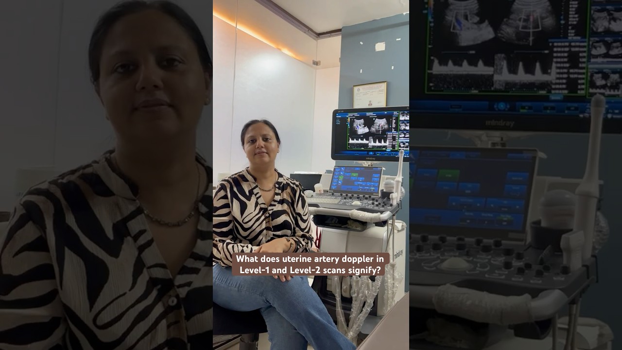 What does uterine artery doppler in Level-1 and Level-2 scans signify?