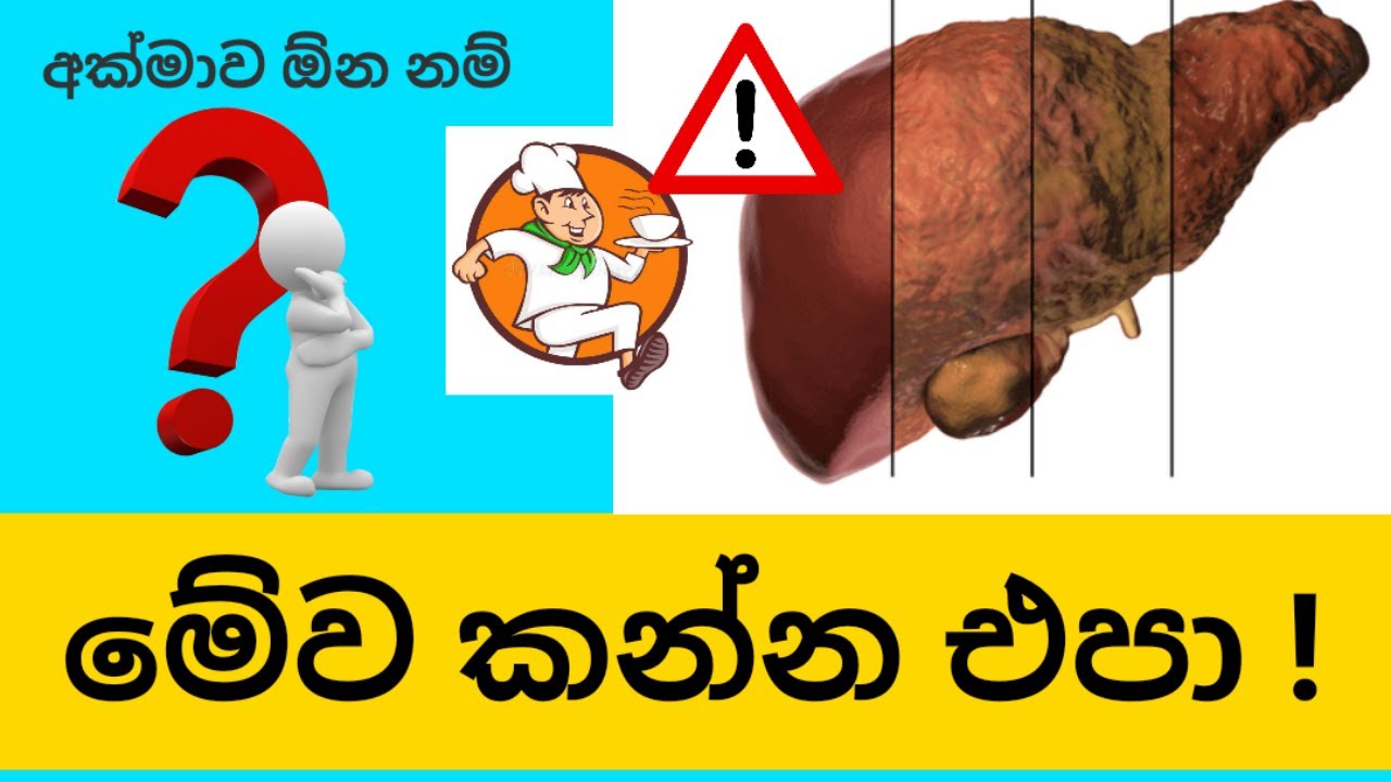 අක්මාව විනාශ කරන අහාර | Poisons for Your Liver in Sinhala By Nutritionist Hiroshan Jayaranga