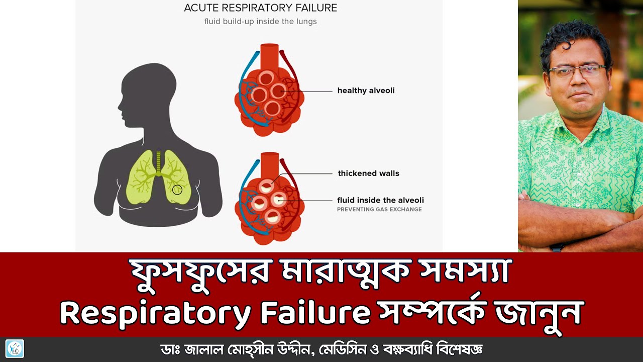 Respiratory Failure কি? শ্বাসকষ্ট অবহেলা করবেন না! (Respiratory Failure symptoms and causes)