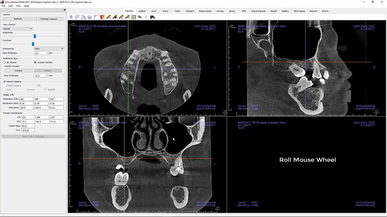 Invivo™ 6 Tutorial - Section View - Getting Started, Part 1