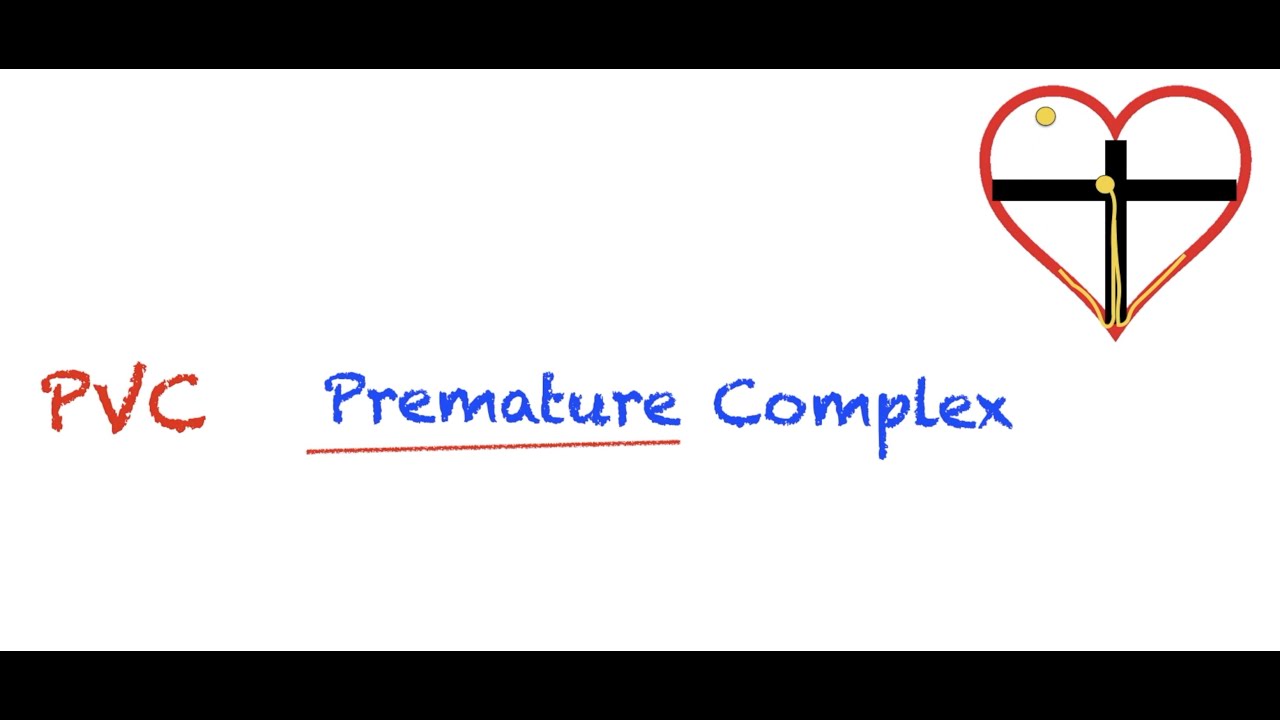 Premature Ventricular Contractions (PVC) Interpretation: Easy and Simple!