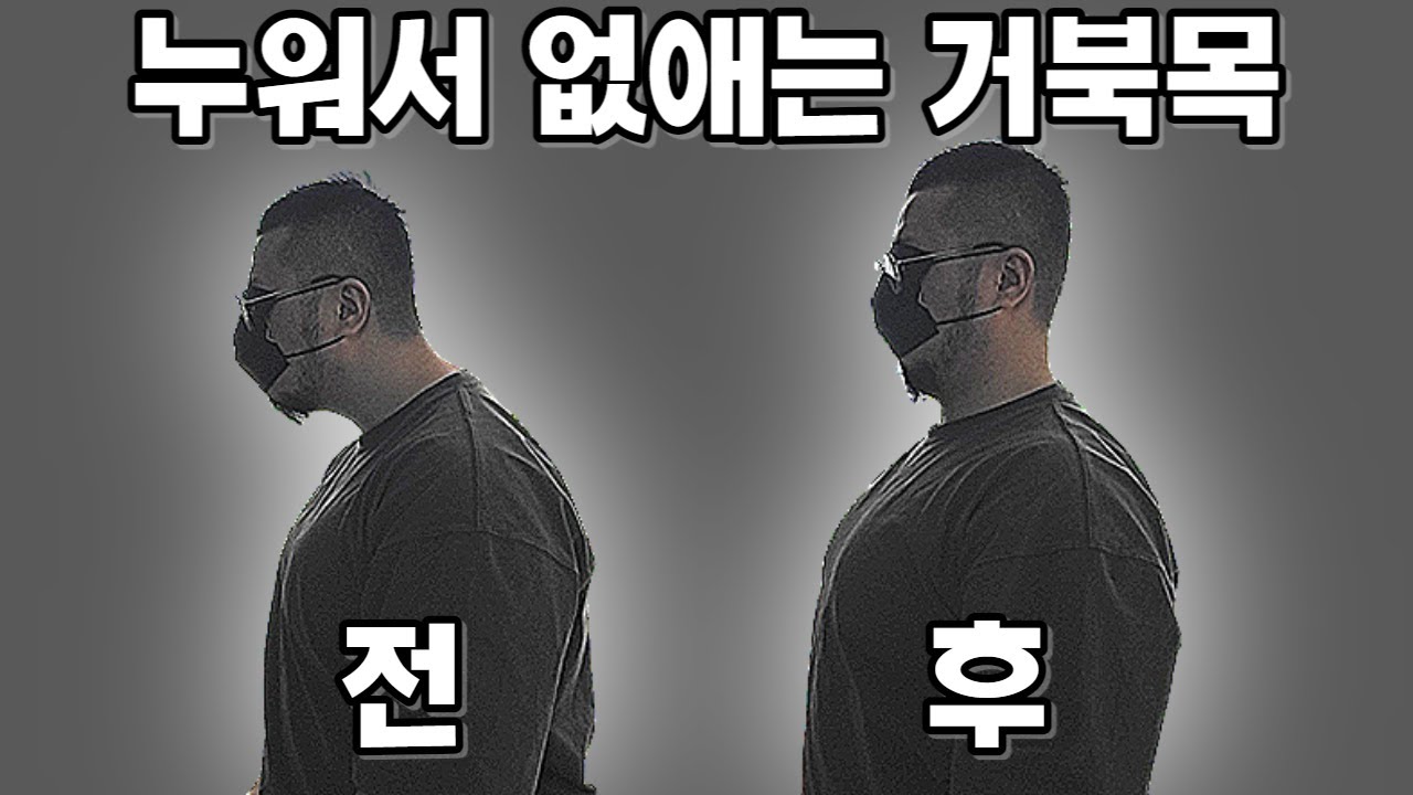 누워서 없애는 거북목