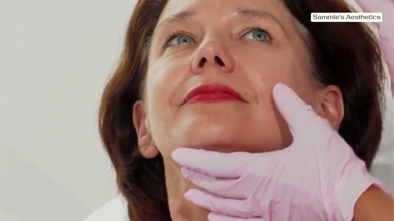 Botox Provider in Fort Worth, TX: Safe, Expert Treatments Explained