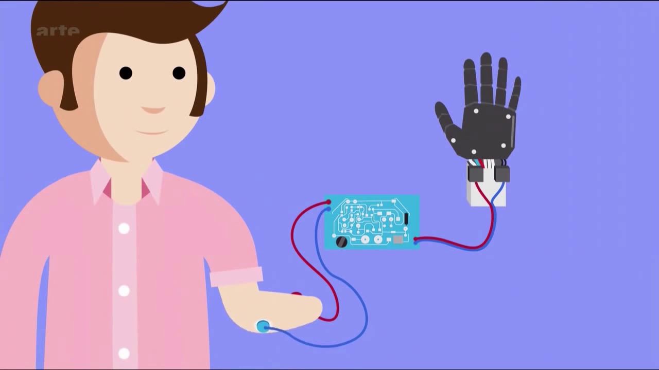 Bionicohand: Une prothese bionique hand made 20 sec (Arte FuturMag)