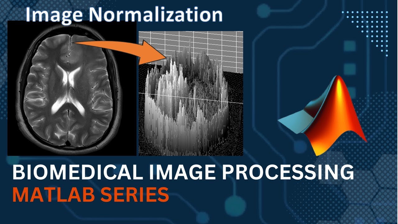 Image Normalization || MATLAB || Medical Image Processing