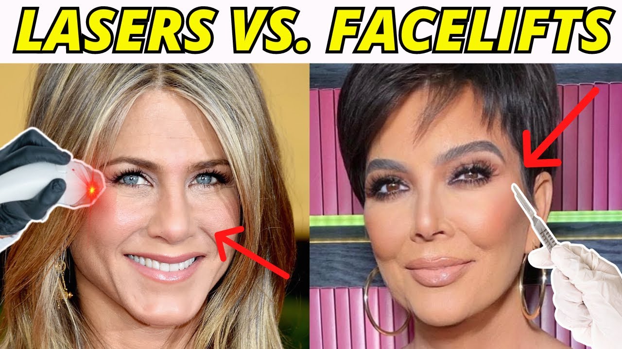 Lasers or Facelifts? The PROS and CONS to Two Powerful Facial Rejuvenation Techniques!