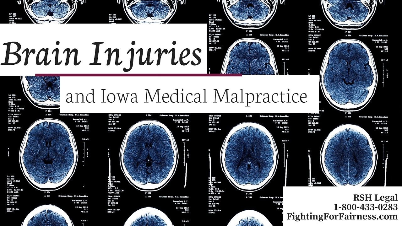 Brain Injuries and Iowa Medical Malpractice