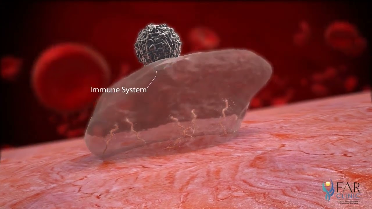 How does Lyme Spirochetes Borrelia cause problems?