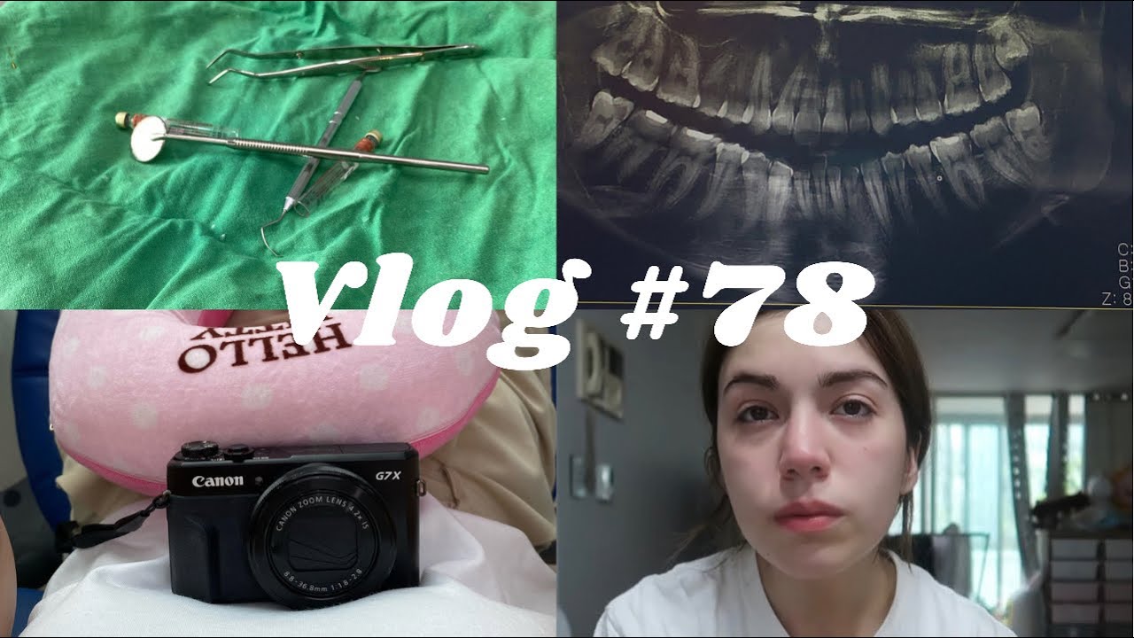 [Vlog #78] BİR 20LİK DİŞ SERÜVENİ🦷| HAYATIMDA HİÇ BU KADAR AĞLAMAMIŞTIM🥺- HER ŞEY ÜST ÜSTE GELDİ