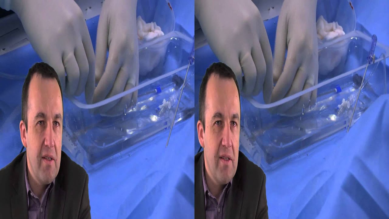 ZAMKNIĘCIE UBYTKU ASD II