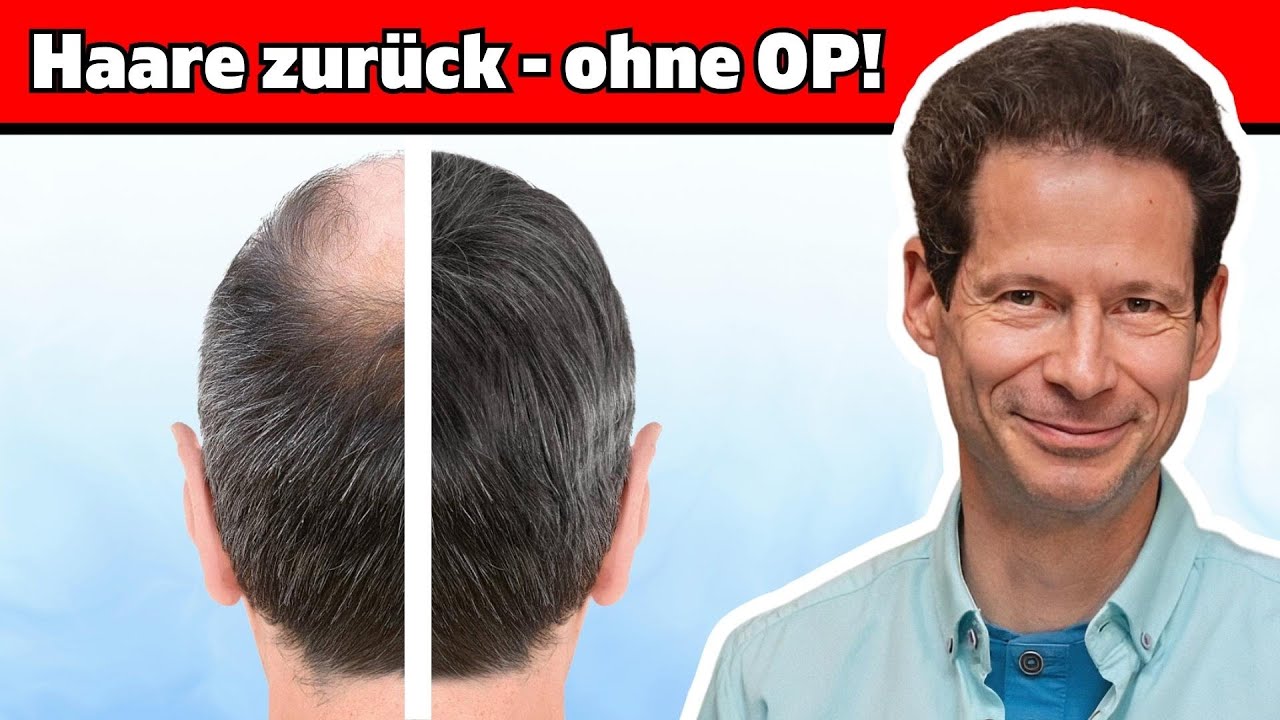 Unglaublich! So bekommst du deine Haare zurück - Dr. Fischer klärt auf