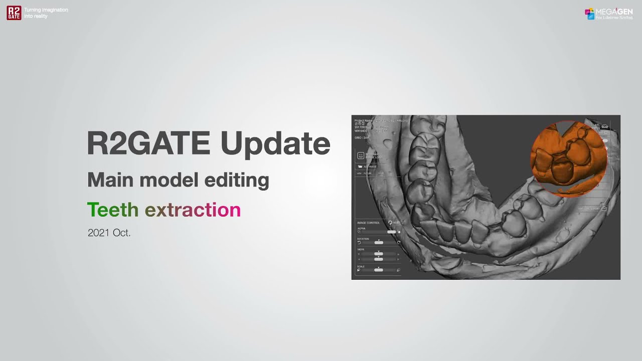 R2GATE Update 2021 Oct. teeth extraction tool