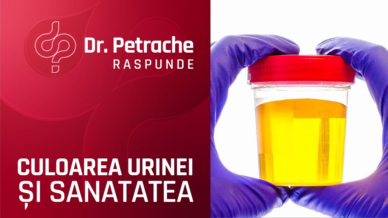 CE SPUNE CULOAREA URINEI DESPRE SANATATEA TA