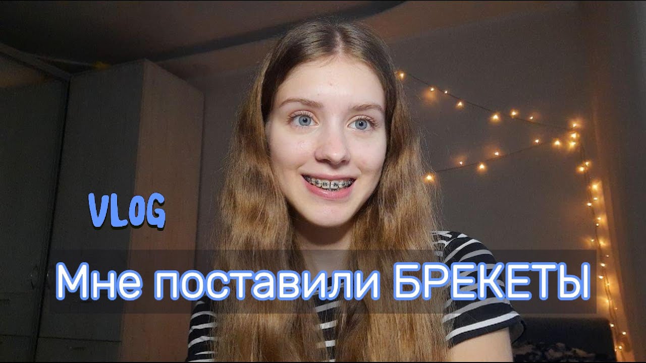 Мне установили БРЕКЕТЫ | Первая неделя с ними | Влог
