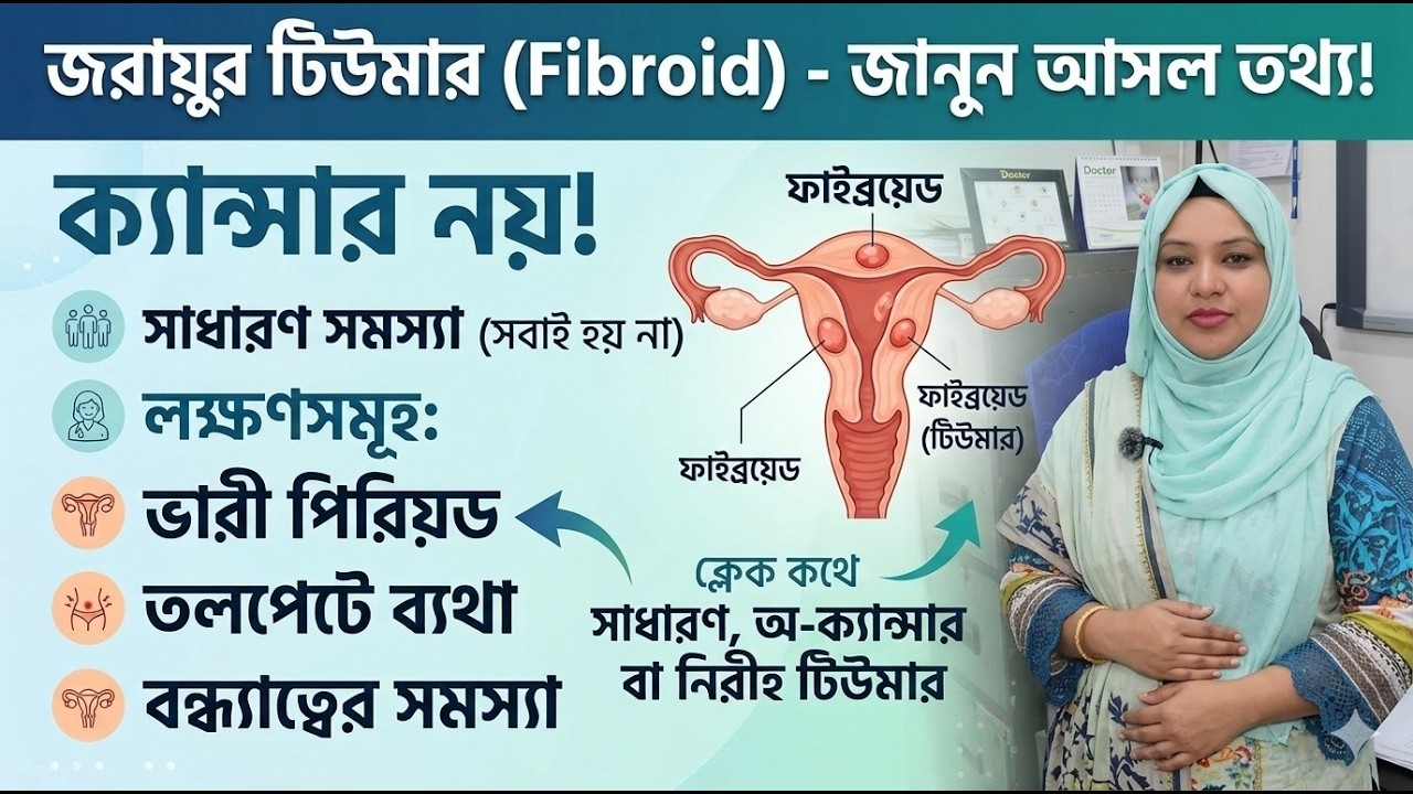 জরায়ু টিউমার Fibroid সম্পর্কে সংক্ষেপে সহজভাবে জানি | SBS Healthy