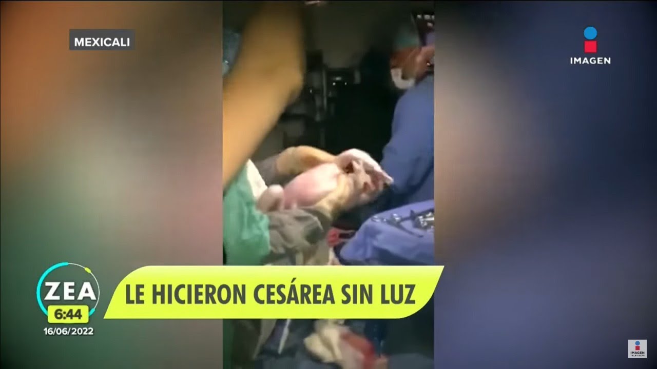 Médicos alumbran cesárea con celulares y cortan oreja a bebé | Noticias con Francisco Zea