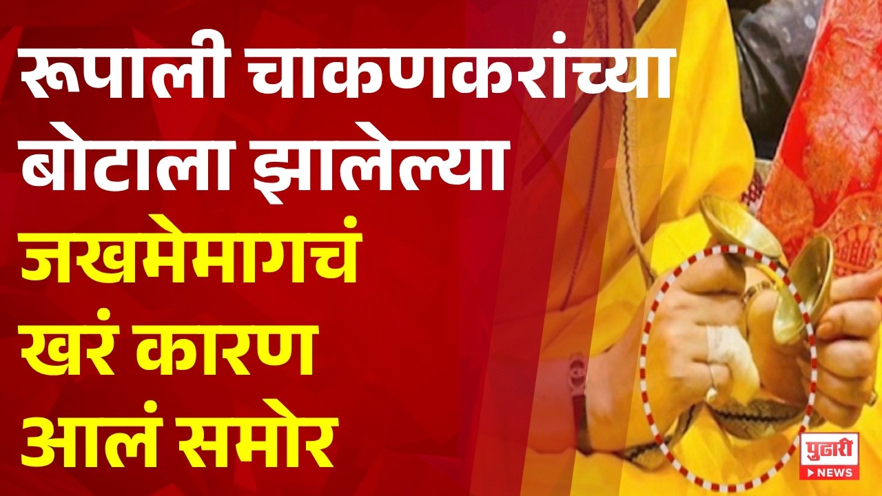 Pudhari News | The real reason behind Rupali Chakankar's finger injury revealed | rupali chakankar