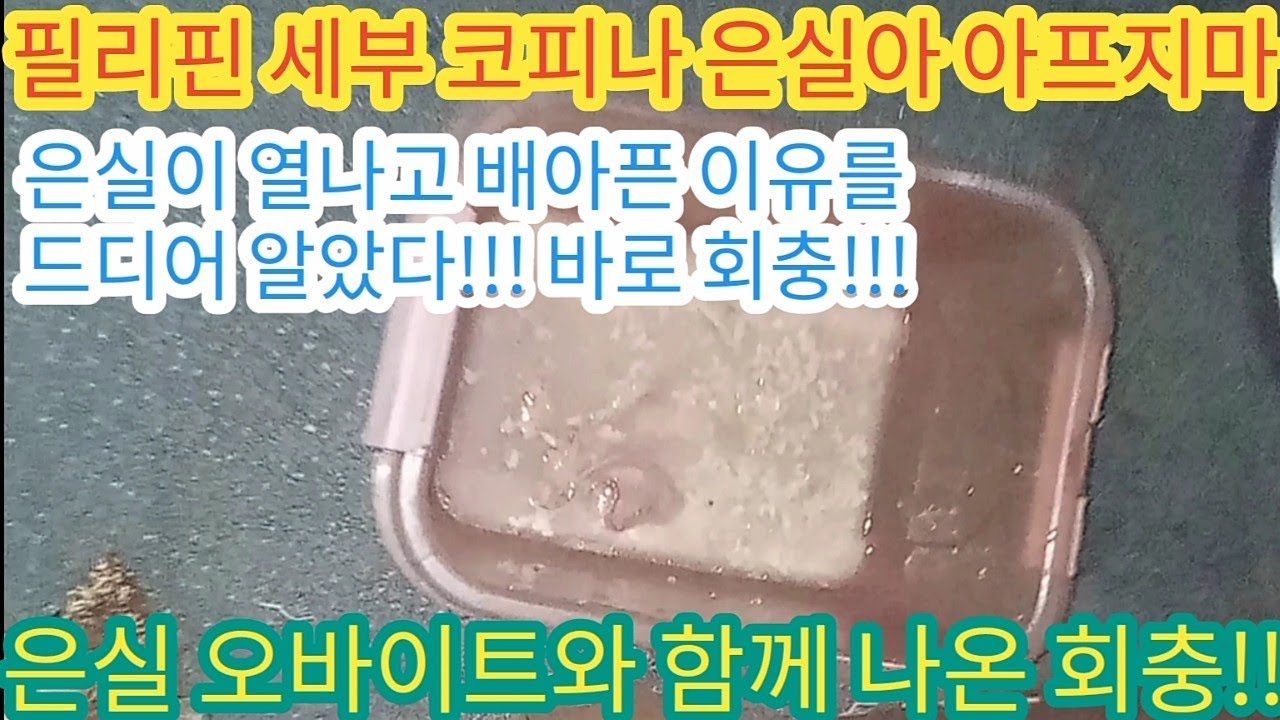구토에서 회충이 나온 우리딸 은실이!! 오바이트와 구토로 아픈우리딸 아프지마!!!