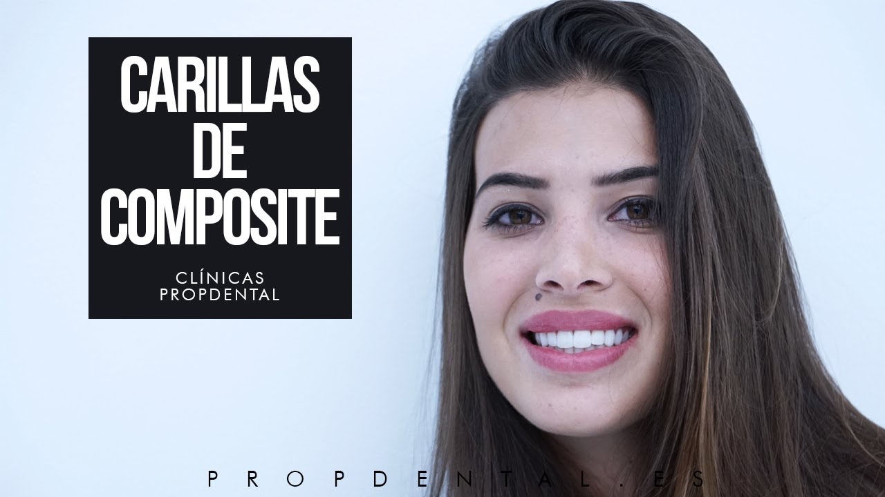 Carillas Composite Miss Barcelona 2017