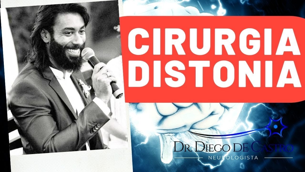Distonia - Conheça a Cirurgia para Distonia